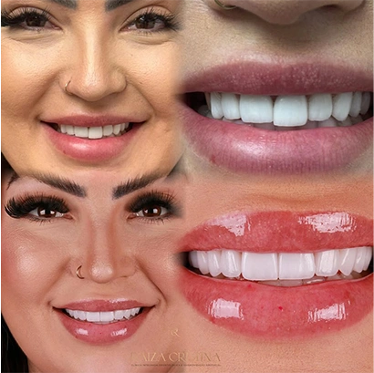 raiza-antes-depois-6